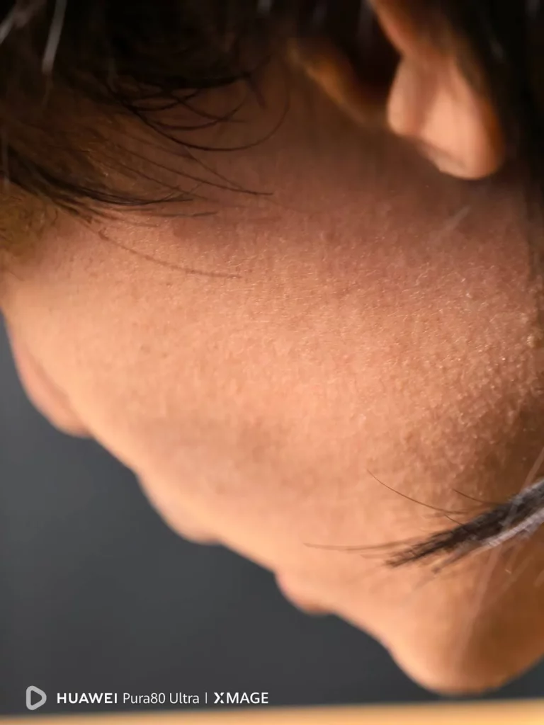 An extreme close-up of human skin, showing pores and fine hairs, suggesting a highly detailed camera capture. The HUAWEI Pura80 Ultra | XMAGE watermark is in the bottom left corner.